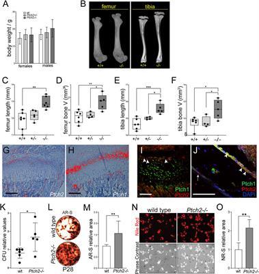 Ptch2 is a Potential Regulator of Mesenchymal Stem Cells